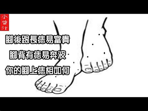 左腳側邊有痣|非富即貴！5種腳相註定好命 痣長在這裡「天生帝王命。